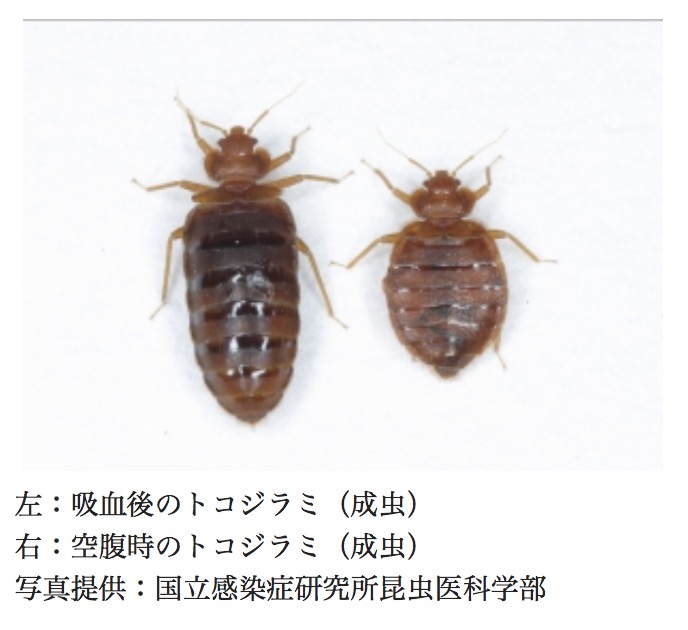 家のダニによる虫刺され